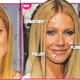 Image for article titled This Week In Tabloids: Heidi Montag Shows Us Her Scars